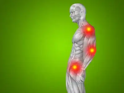 人类肌肉与关节或骨骼疼痛照片