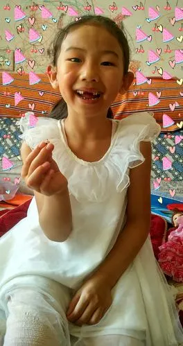 开启真正的豁牙子时代