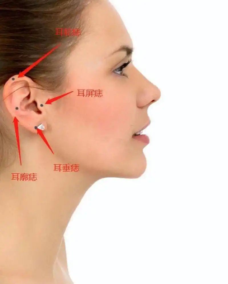 耳垂有痣的人,耳垂是耳朵上最显福气的地方,如弥勒佛,耳垂过肩,际是