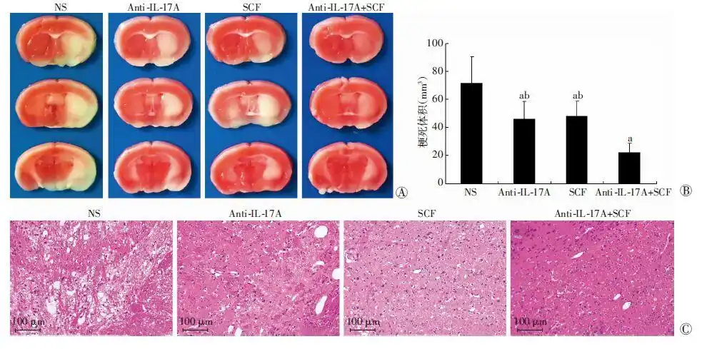 干细胞因子联合抗白细胞介素17a抗体对小鼠脑缺血预后的影响