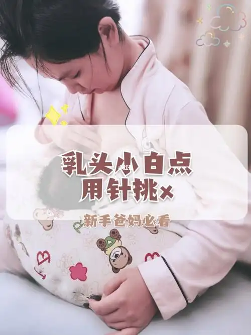 乳头有小白点可以用针挑吗