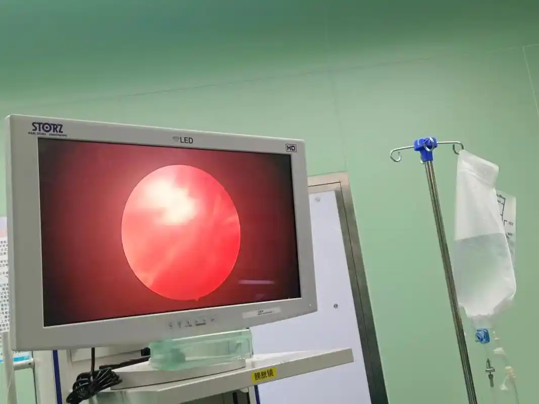 日喀则市首例宫腔镜通液术在日喀则市人民医院成功开展