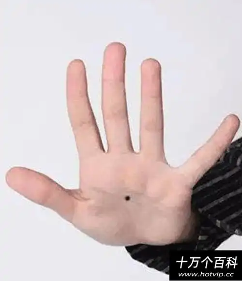 一,手心有痣;手心有痣代表你是一个聪明而不缺钱用的人,手掌中心有痣