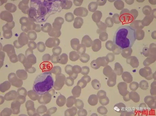 看图识细胞第72期