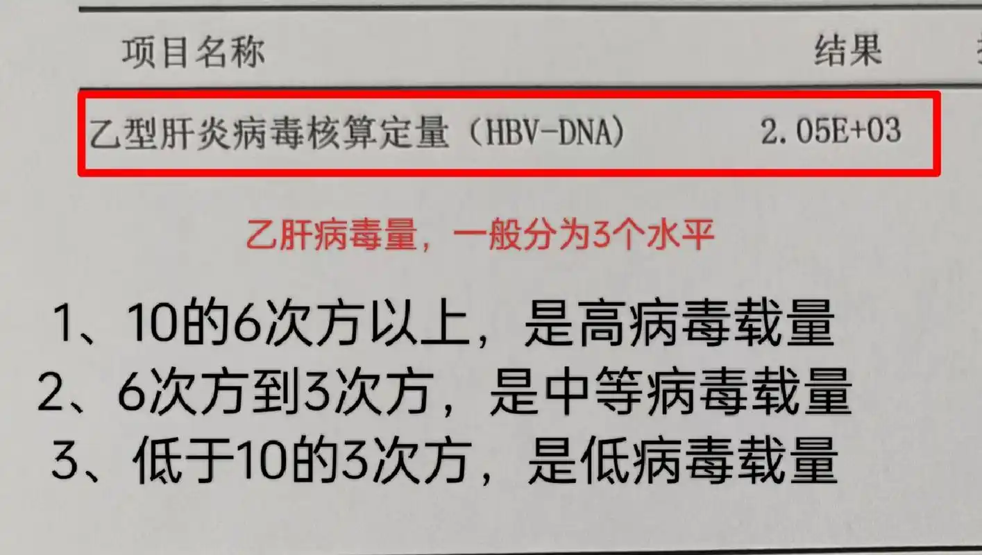 乙肝病毒dna检测,怎么看,我教你#乙肝# #科普# #涨知识
