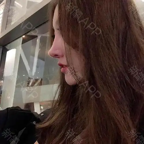 肋软骨隆鼻还是蛮稳定的