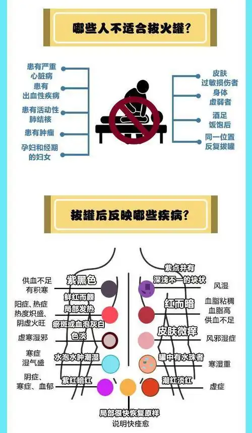 拔罐12个位置示意图
