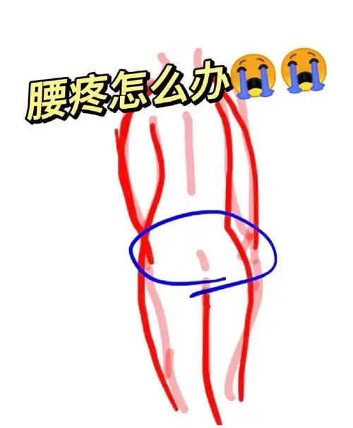 前阵子开始腰疼,尾骶骨这块特别疼,坐着疼,走路久了疼睡觉也疼,做了