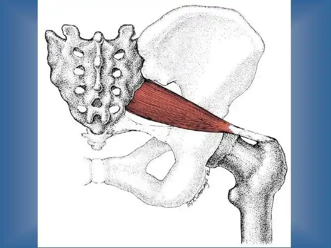 梨状肌综合征ppt
