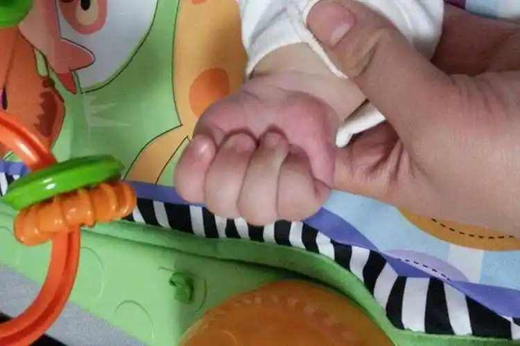 拇指内扣的宝宝会很笨?这个月龄后若还未张开,需要及时就医