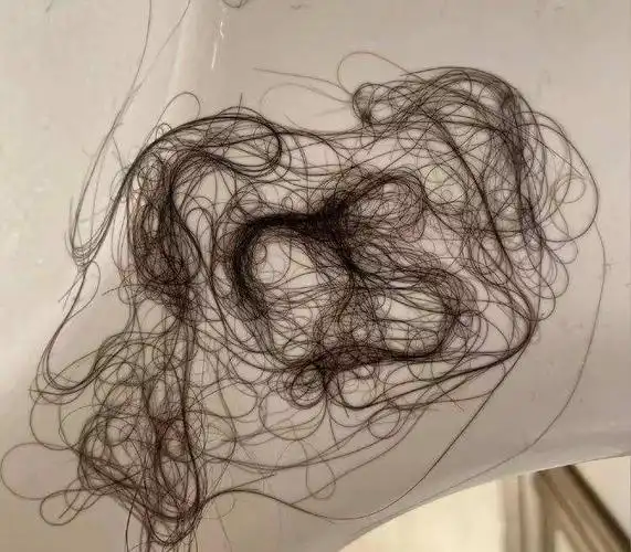 也就是差不多三年前发现自己开始脱发的,年轻的时候觉得洗头发掉点