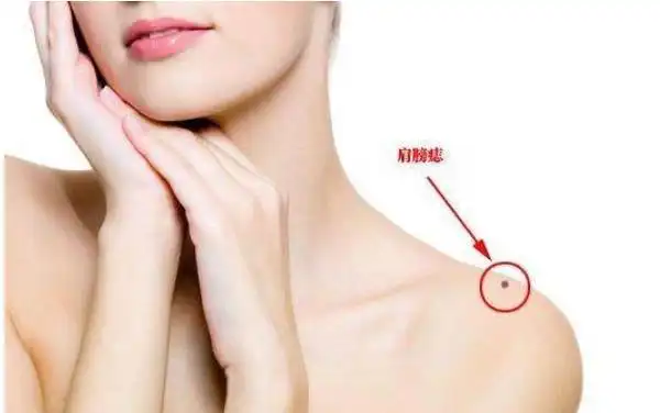 女人肩膀长痣看命运