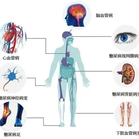 硫辛酸片:糖尿病并发症危害大,这些并发症不可不防!