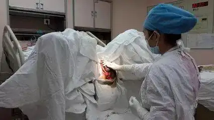 长沙一名男医生为产妇接生,危急时刻用嘴吸出羊水.