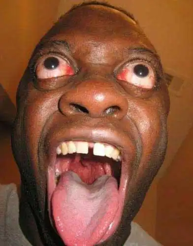 主题:牛人猛图,翻白眼的最高境界