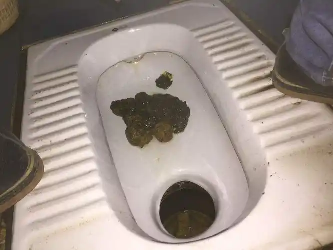 以前有过慢性肠胃炎,经常都是拉稀,最近粪便感觉很异常,肚子也不痛,我