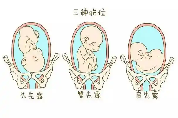 怀男孩一般这种胎位比较多看看你是吗