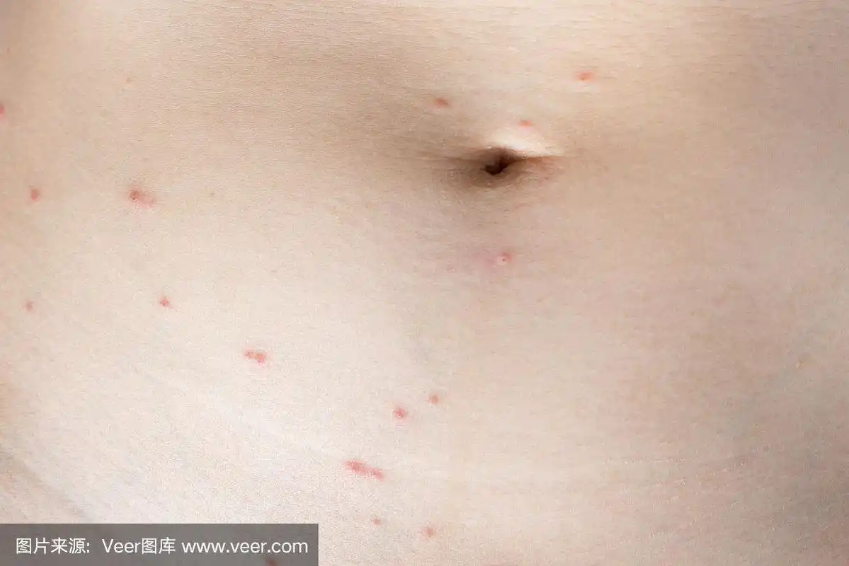 皮肤,特写,蜱,肚脐,四肢