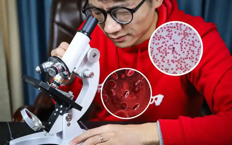 挑战把血液放大2400倍,看到了密密麻麻的红细胞,密集恐惧症!