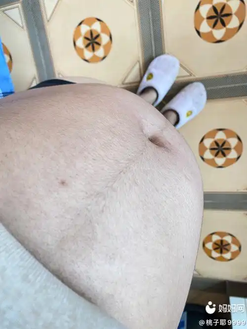 我才19周 我肚子这样看好大已经去私人医院查了 儿子 胎动一到晚上就