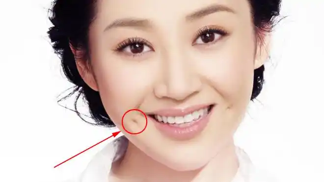 酒窝长在两边的腮骨上,笑起来就像是一个凹陷的小坑,给人以纯真,甜美