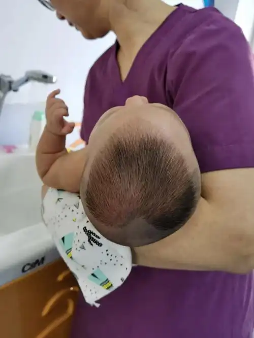 女儿的偏头一个月睡圆了