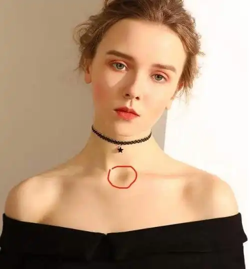 锁骨上有痣_锁骨上淋巴结肿大者已属晚期_锁骨上淋巴结肿大吃什么药