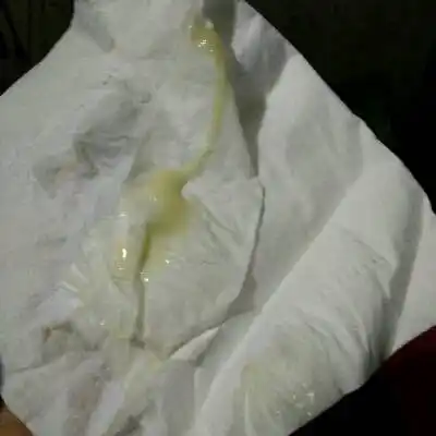 我发现,月经期前两天,有点腰酸背痛,下面偶尔有点痒,是患了阴道炎了?