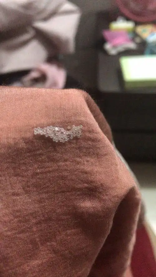 慎入吧今天看到衣服上的虫卵差点没被吓晕过去