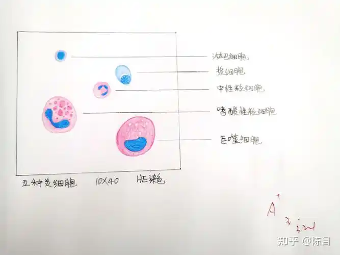 慢性肺淤血  4.肾的贫血性梗死  5.炎细胞  6.肾脓肿  7.