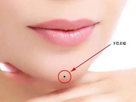 下巴有痣好不好女人下巴有痣是富贵命吗