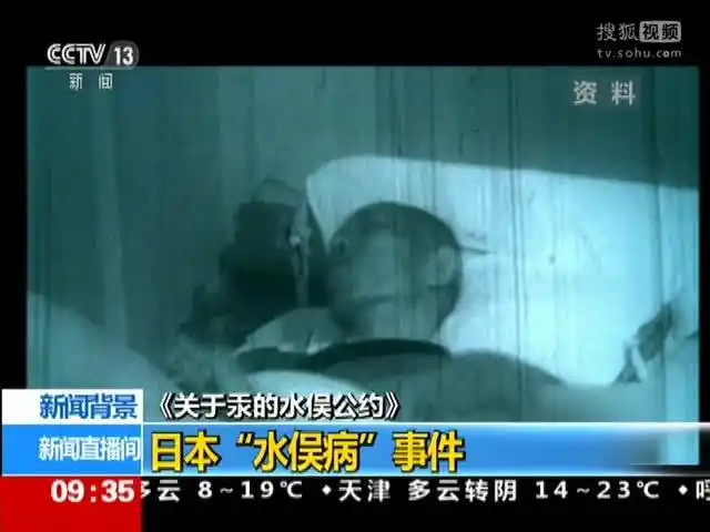 新闻背景日本水俣病事件