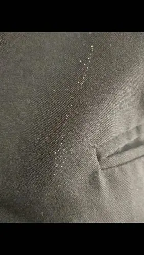 我家衣服挂的衣服里面有很多蚊子 ,请问一下,这个衣服上的这个点点是