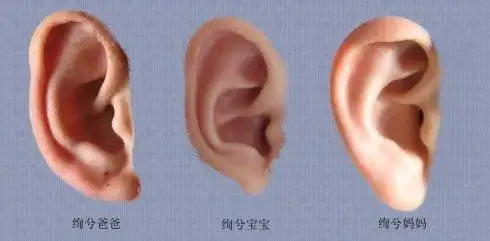 67第四种,耳珠大,耳珠朝口耳朵又主肾.耳朵形美轮廓分明,主运程佳.