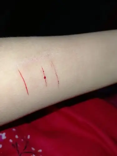 2021-01-04 05:50:39 倾听者感情咨询 0 来啊快活啊自残啊