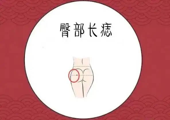 同款痣 #关注我每天分享知识 #痣的魅力发散时间 #痣的含 - 抖音