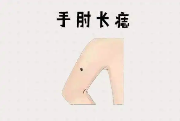 1,手肘外长痣手肘外长痣的人一般赚钱能力强,会理财,因此即使收入不是