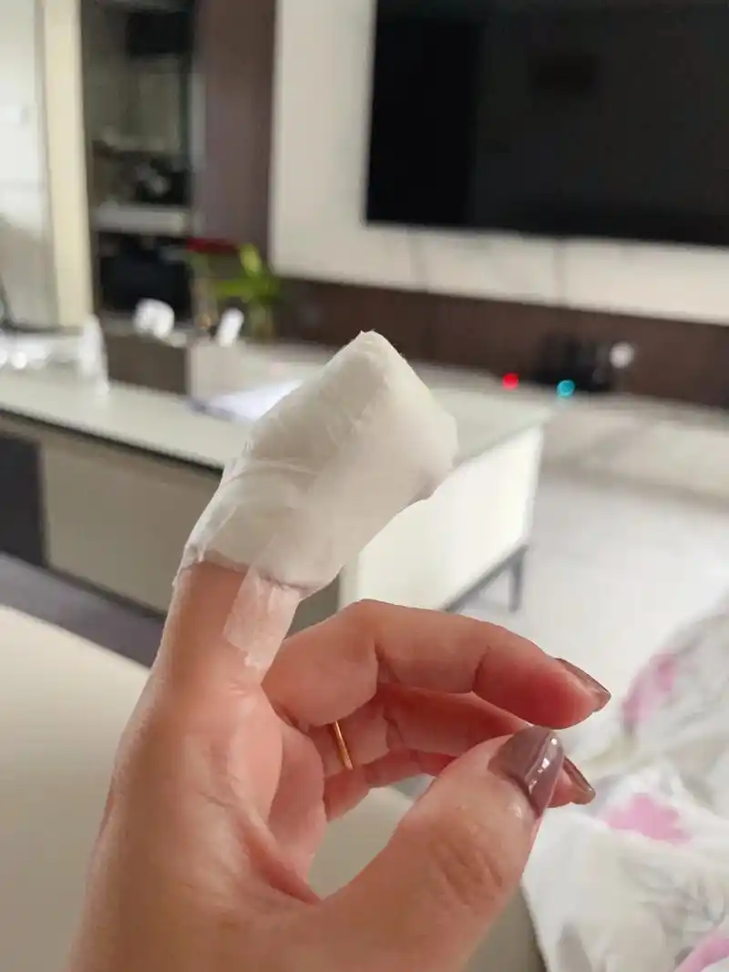 上辈子辜负了谁?硬生生的给自己来了六针#左手食指有疤 - 抖音