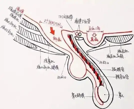 宝宝患上疝气该如何治疗