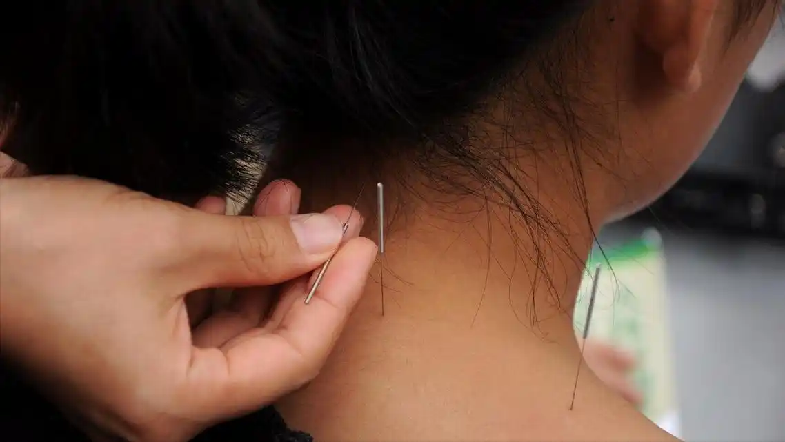 13岁女孩针灸治疗后不幸死亡,针灸到底安全吗?真相在这里
