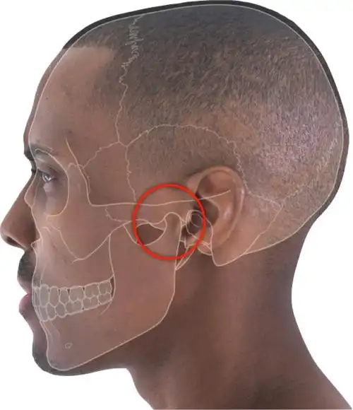 关节虽小损伤事大正确呵护颞下颌关节原创