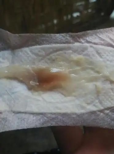 中午去洗手间,换下来的护垫  怎么是这个颜色了,这褐色的分泌物,黏黏