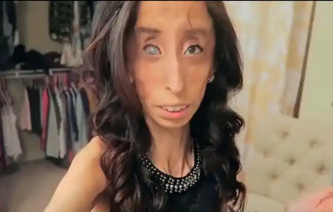 但是有这么一位女子,瘦骨嶙峋,两只眼睛大小不一,全身都是皮包骨,乍