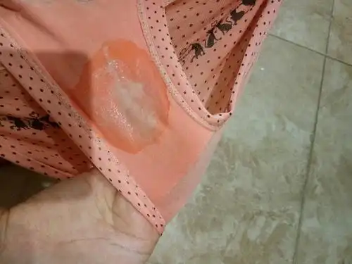 [有图]想问一下 今天发现白带浆糊状 内裤还湿了一.