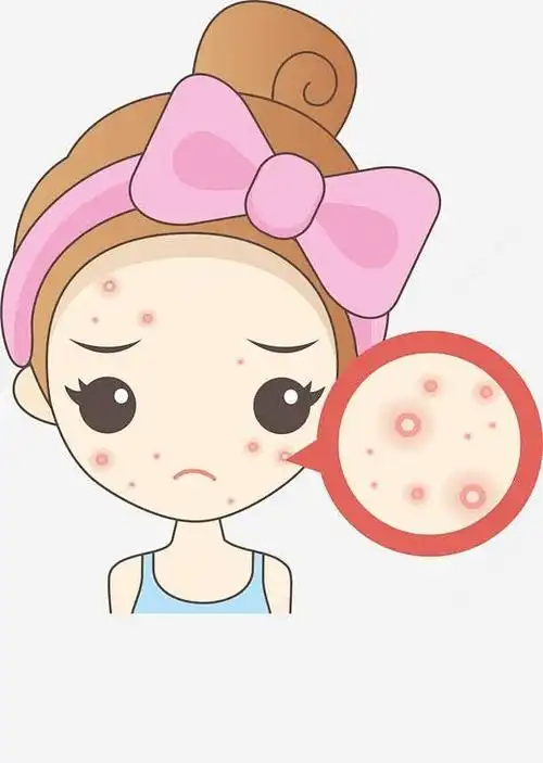 保湿|控油|痘印|痘痘|精华乳|敏感肌肤_网易订阅