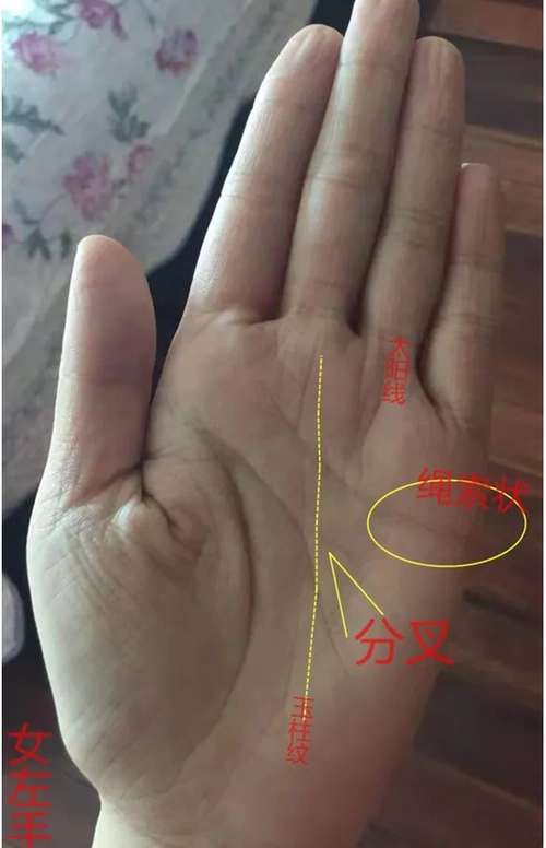 太阳线明显,事业成功率较大,一生不断钱财;但是智慧线明显出现分叉的