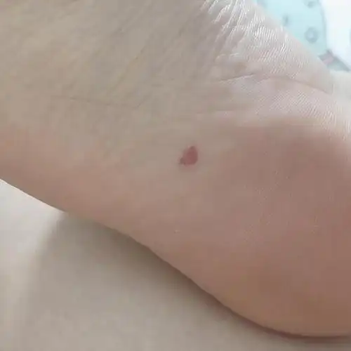 脚心有红痣是啥意思