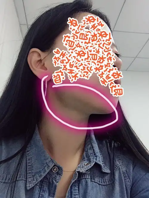 石原里美下颌线有用!下颚到脖子连接处一块很松弛的肉可能墩到答案了!