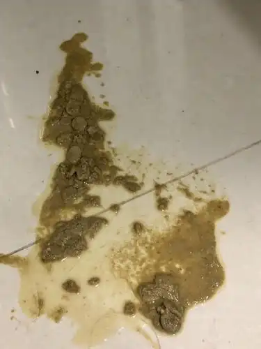 下附呕吐物图 (慎)