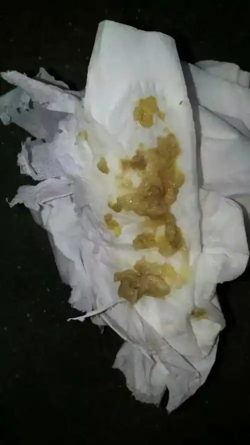 棒女郎下阴排毒法!慎点!